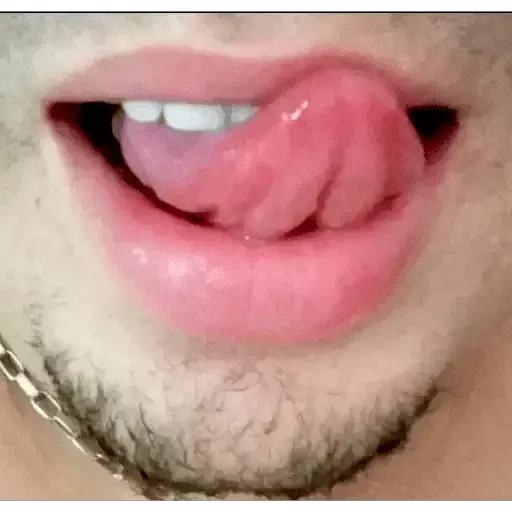 stickers_Hot